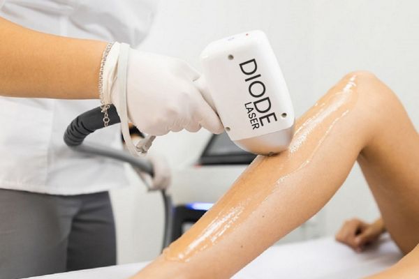 Xu hướng phát triển công nghệ diode laser